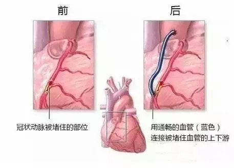 通草的功效与作用能通输卵管堵塞,可持续发展实施探索_C版31.585